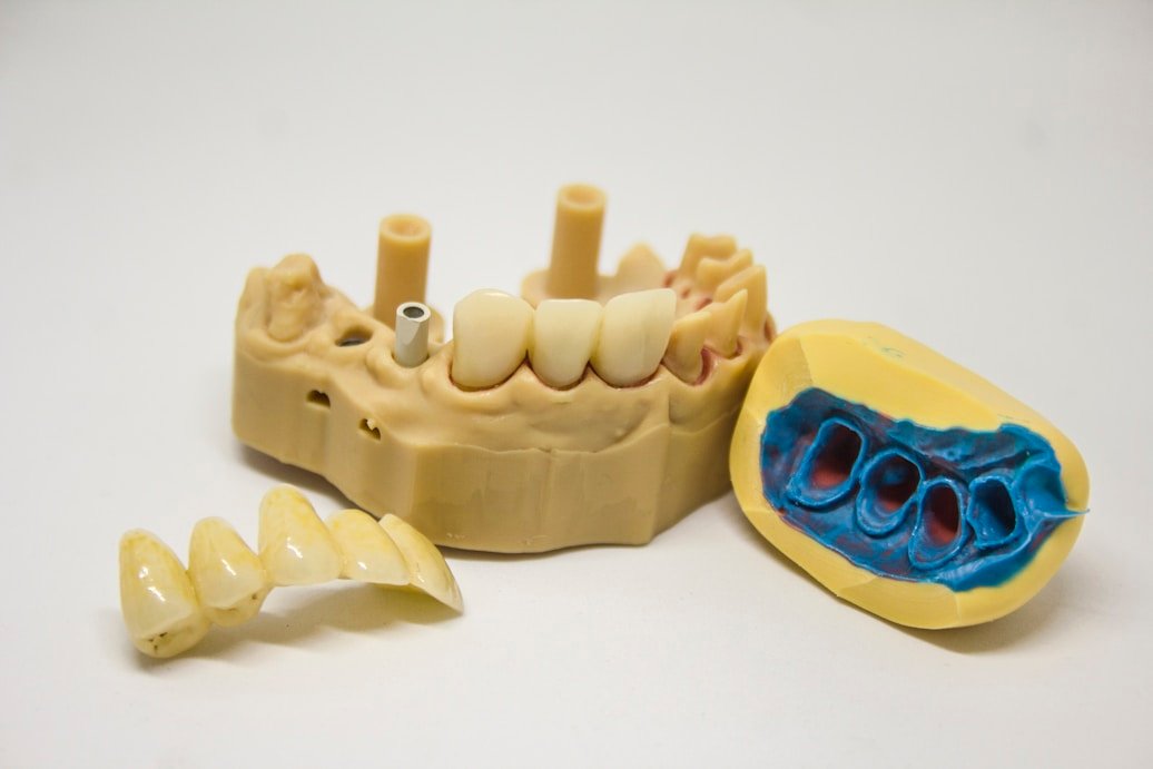 Crowns at First Dental Grove Park